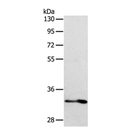 IL1RL1 Antibody from Signalway Antibody (35992) - Antibodies.com