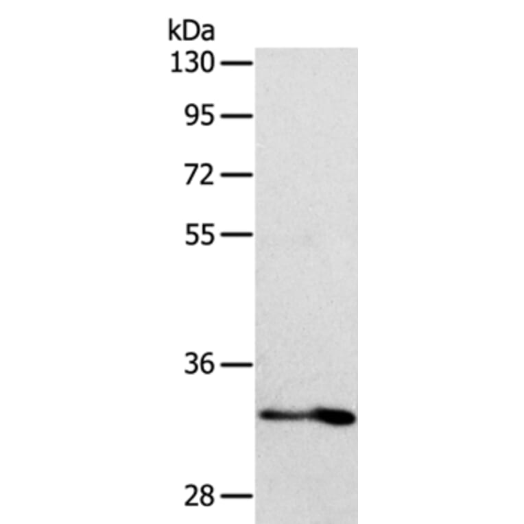 IL1RL1 Antibody from Signalway Antibody (35992) - Antibodies.com