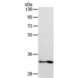 IL1RL1 Antibody from Signalway Antibody (35992) - Antibodies.com