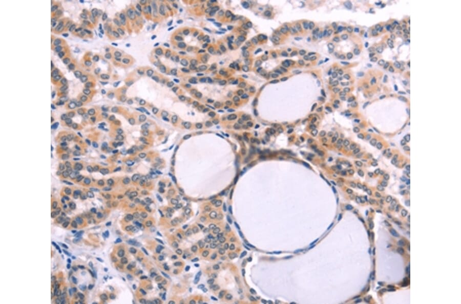 Immunohistochemistry - IL1RL1 Antibody from Signalway Antibody (35992) - Antibodies.com