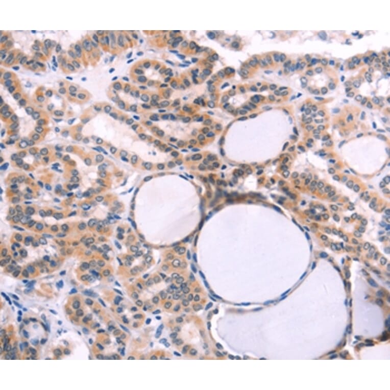 Immunohistochemistry - IL1RL1 Antibody from Signalway Antibody (35992) - Antibodies.com