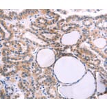 Immunohistochemistry - IL1RL1 Antibody from Signalway Antibody (35992) - Antibodies.com