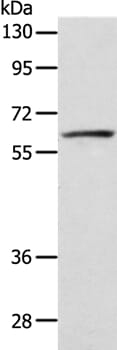 Gel: 8% SDS-PAGE Lysate: 40ug Hela cell Primary antibody: 1/250 dilution Secondary antibody dilution: 1/8000 Exposure time: 5 seconds