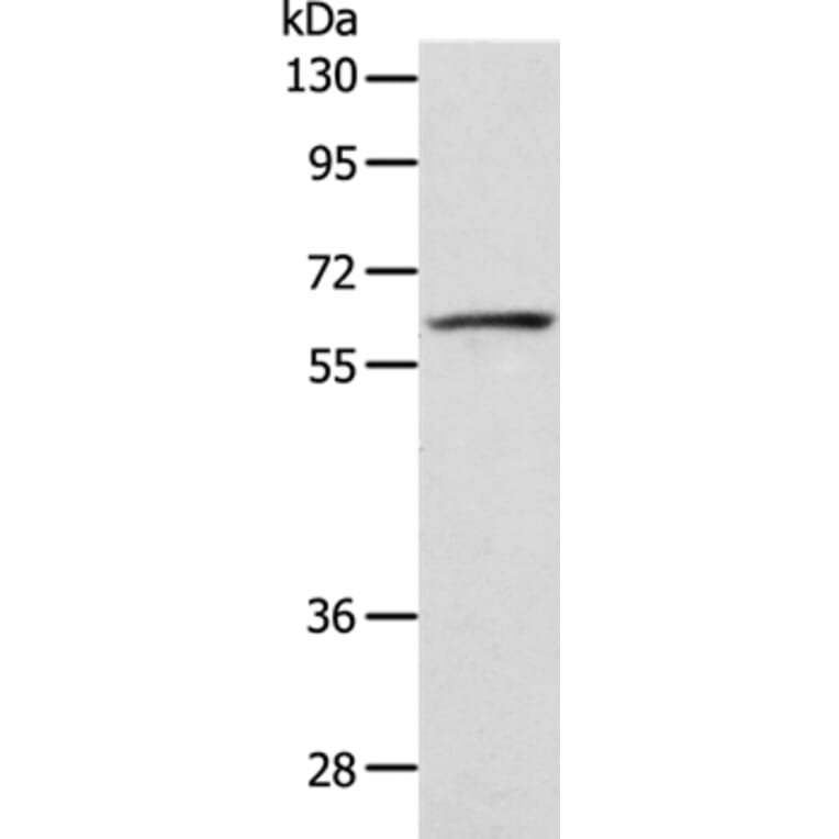 VANGL1 Antibody from Signalway Antibody (35999) - Antibodies.com
