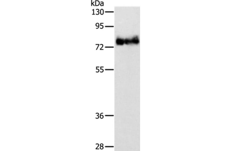 ABLIM1 Antibody from Signalway Antibody (36011) - Antibodies.com