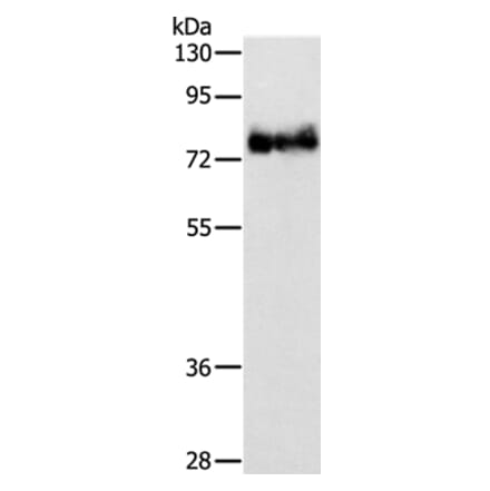 ABLIM1 Antibody from Signalway Antibody (36011) - Antibodies.com
