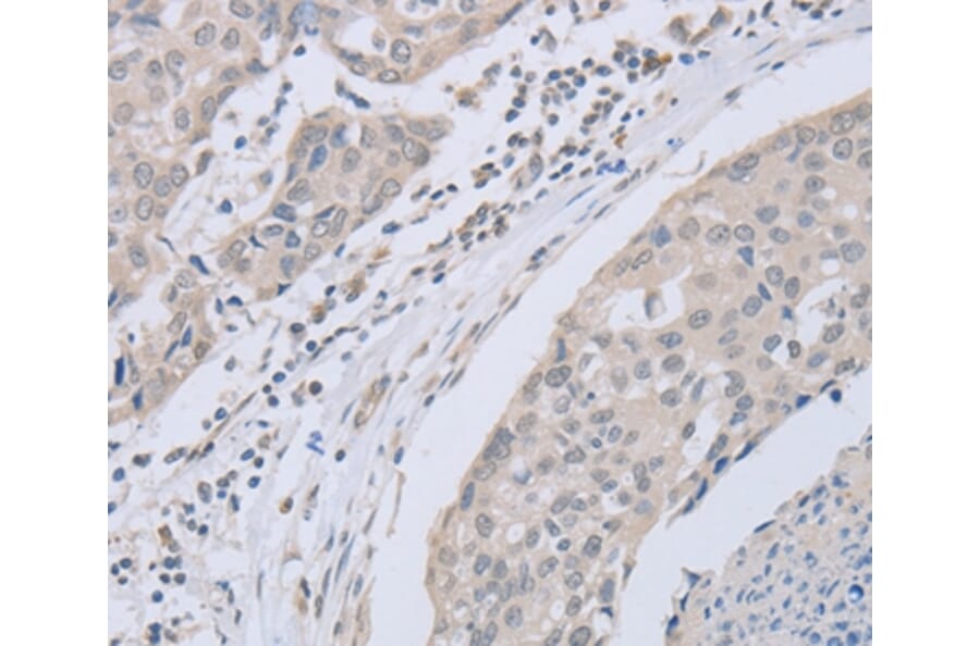 Immunohistochemistry - ABLIM1 Antibody from Signalway Antibody (36011) - Antibodies.com