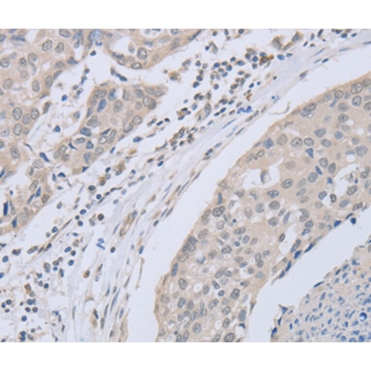 Immunohistochemistry - ABLIM1 Antibody from Signalway Antibody (36011) - Antibodies.com