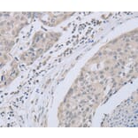 Immunohistochemistry - ABLIM1 Antibody from Signalway Antibody (36011) - Antibodies.com