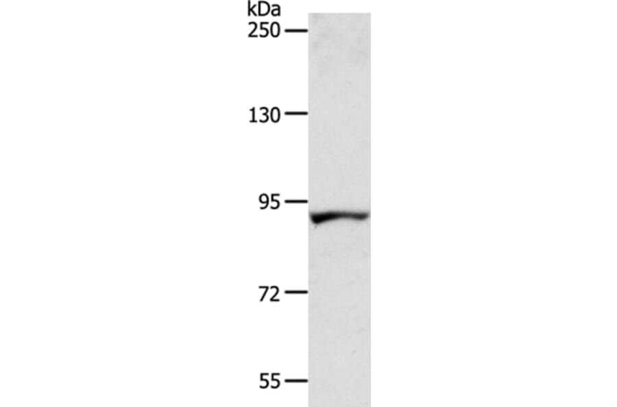 ACAD11 Antibody from Signalway Antibody (36016) - Antibodies.com