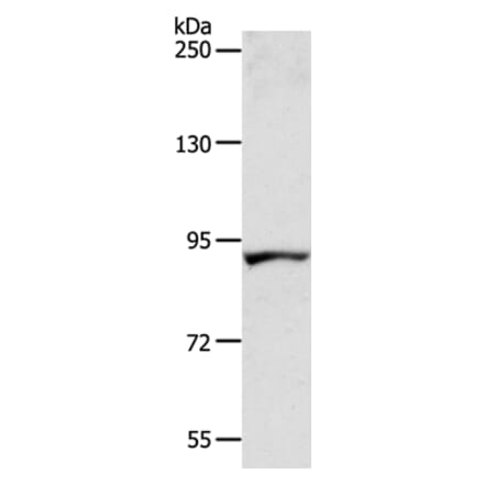 ACAD11 Antibody from Signalway Antibody (36016) - Antibodies.com