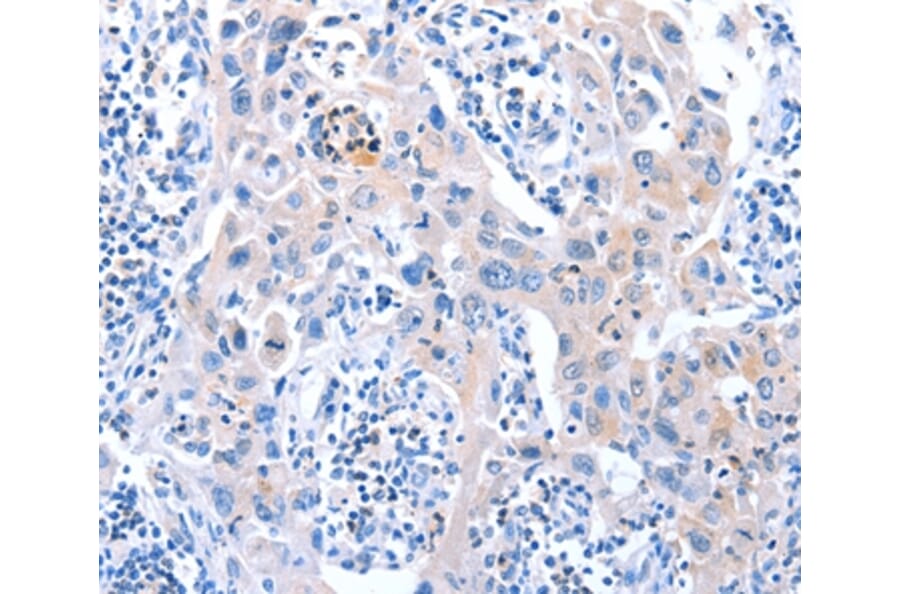 Immunohistochemistry - ACAD11 Antibody from Signalway Antibody (36016) - Antibodies.com