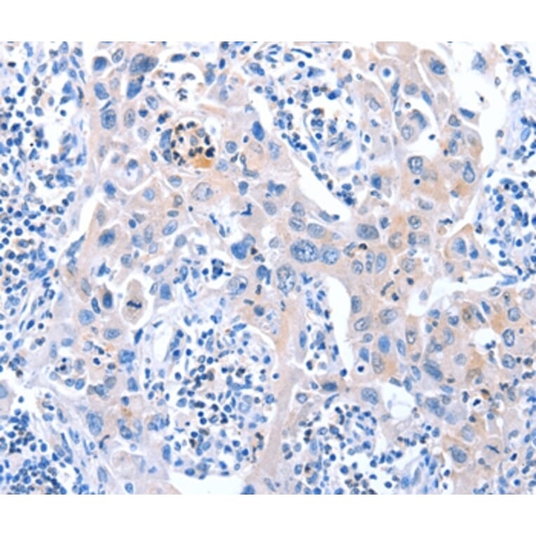Immunohistochemistry - ACAD11 Antibody from Signalway Antibody (36016) - Antibodies.com