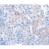 Immunohistochemistry - ACAD11 Antibody from Signalway Antibody (36016) - Antibodies.com