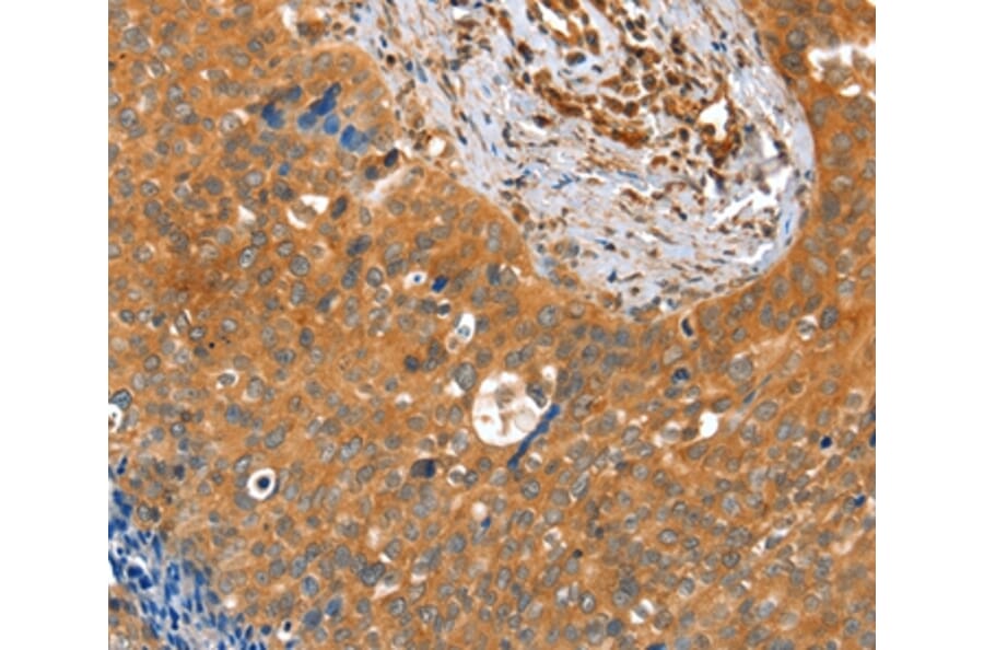 Immunohistochemistry - ACOT11 Antibody from Signalway Antibody (36020) - Antibodies.com