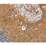 Immunohistochemistry - ACOT11 Antibody from Signalway Antibody (36020) - Antibodies.com