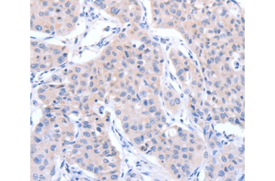 Immunohistochemistry - ACTR3B Antibody from Signalway Antibody (36032) - Antibodies.com