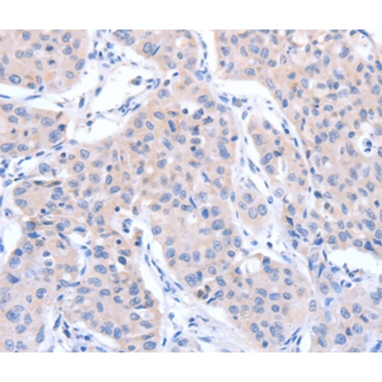 Immunohistochemistry - ACTR3B Antibody from Signalway Antibody (36032) - Antibodies.com