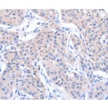 Immunohistochemistry - ACTR3B Antibody from Signalway Antibody (36032) - Antibodies.com