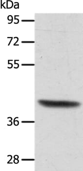 Gel: 10% SDS-PAGE Lysates (from left to right): Human lymphoma tissue Amount of lysate: 40ug per lane Primary antibody: 1/350 dilution Secondary antibody dilution: 1/8000 Exposure time: 5 seconds
