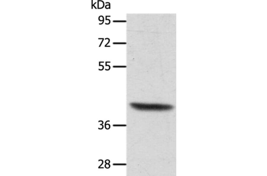 ACTRT1 Antibody from Signalway Antibody (36033) - Antibodies.com