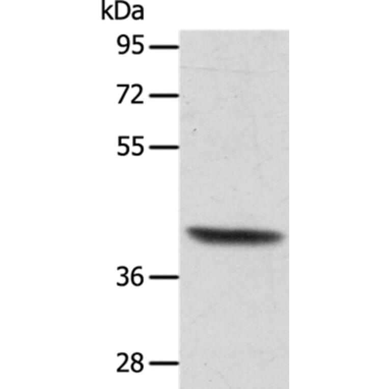 ACTRT1 Antibody from Signalway Antibody (36033) - Antibodies.com