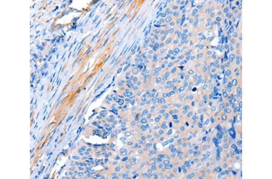 Immunohistochemistry - ACTRT1 Antibody from Signalway Antibody (36033) - Antibodies.com