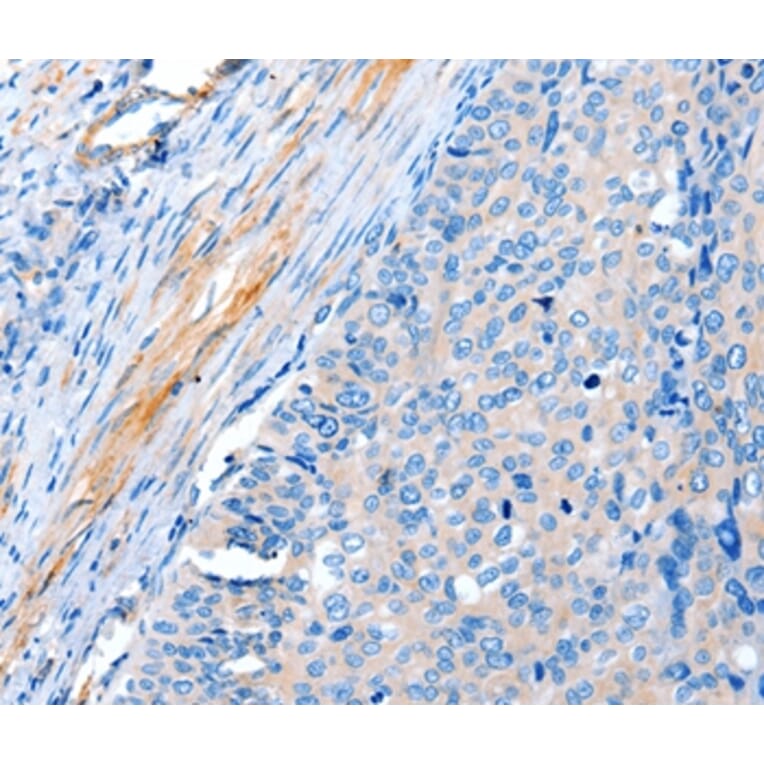 Immunohistochemistry - ACTRT1 Antibody from Signalway Antibody (36033) - Antibodies.com