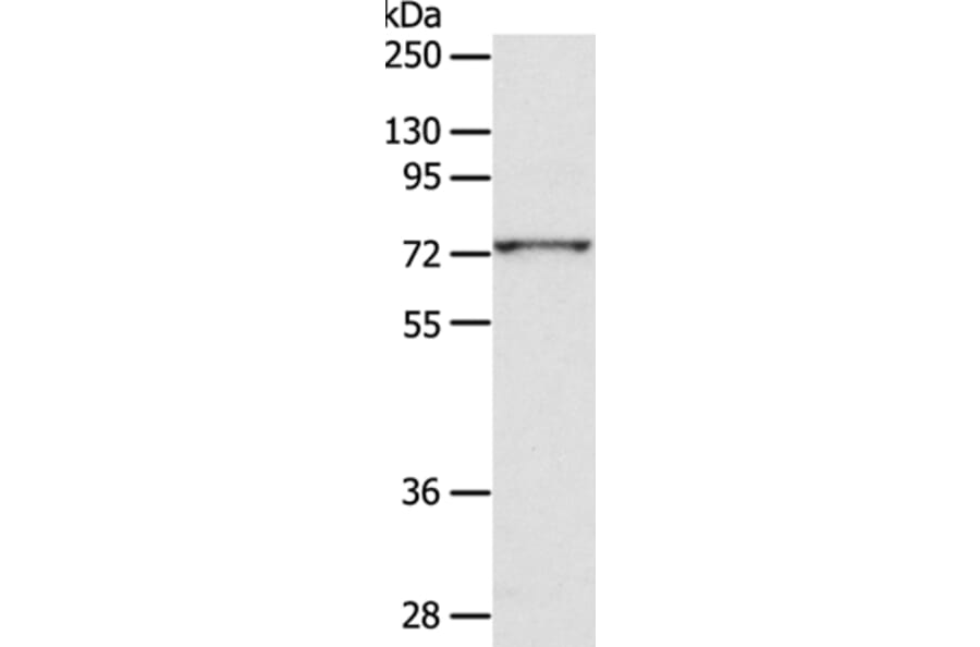 ADAM10 Antibody from Signalway Antibody (36038) - Antibodies.com