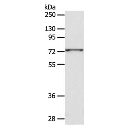 ADAM10 Antibody from Signalway Antibody (36038) - Antibodies.com