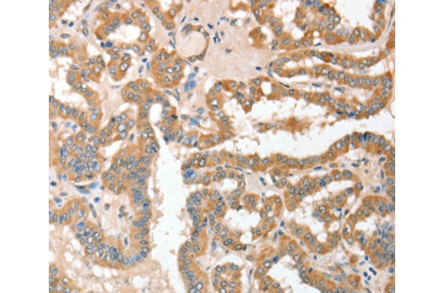 Immunohistochemistry - ADAM10 Antibody from Signalway Antibody (36038) - Antibodies.com