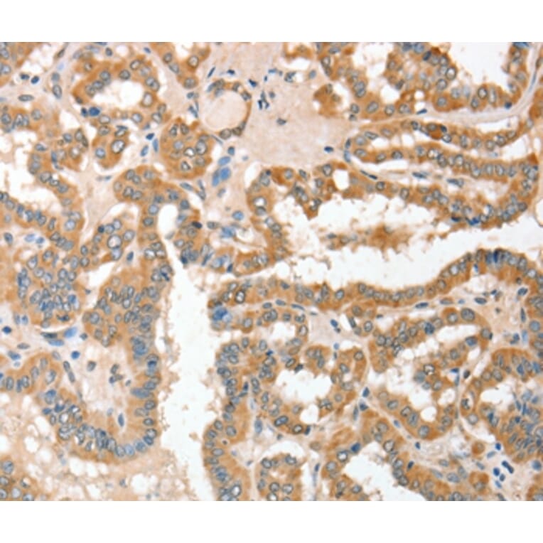 Immunohistochemistry - ADAM10 Antibody from Signalway Antibody (36038) - Antibodies.com