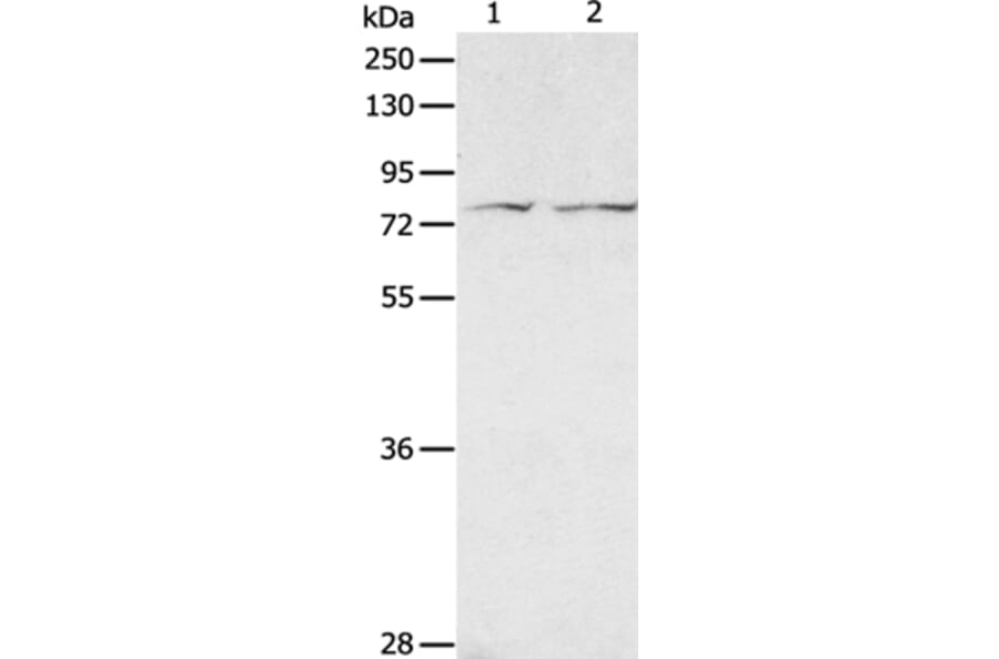 ADAM20 Antibody from Signalway Antibody (36039) - Antibodies.com