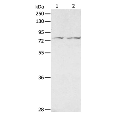 ADAM20 Antibody from Signalway Antibody (36039) - Antibodies.com