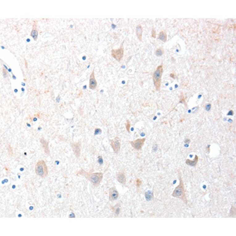 Immunohistochemistry - ADAM20 Antibody from Signalway Antibody (36039) - Antibodies.com