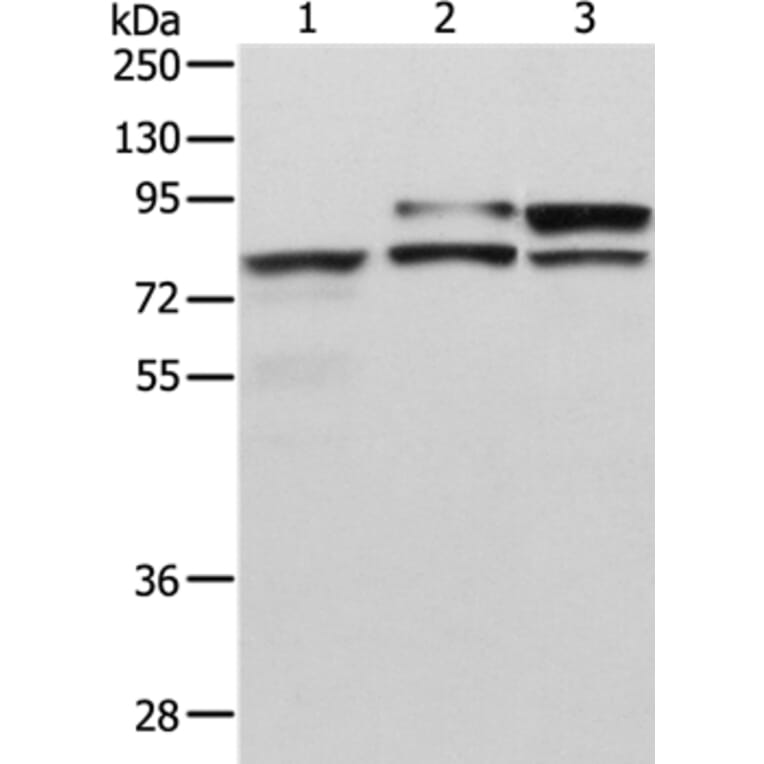 ADAM15 Antibody from Signalway Antibody (36040) - Antibodies.com