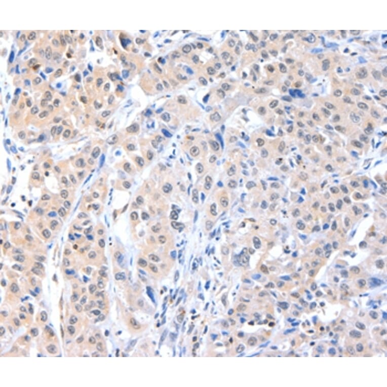 Immunohistochemistry - ADAM15 Antibody from Signalway Antibody (36040) - Antibodies.com