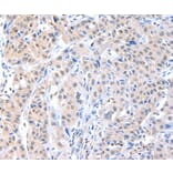 Immunohistochemistry - ADAM15 Antibody from Signalway Antibody (36040) - Antibodies.com