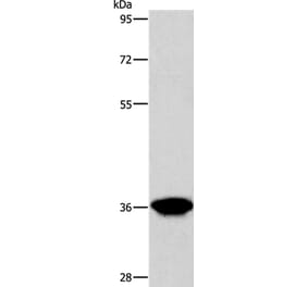 AKR1D1 Antibody from Signalway Antibody (36072) - Antibodies.com