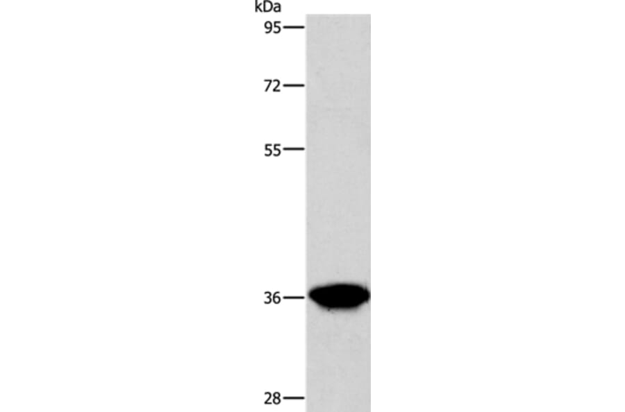 AKR1D1 Antibody from Signalway Antibody (36072) - Antibodies.com