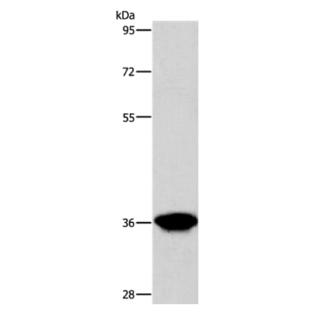 AKR1D1 Antibody from Signalway Antibody (36072) - Antibodies.com