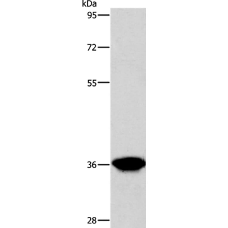 AKR1D1 Antibody from Signalway Antibody (36072) - Antibodies.com