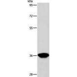 AKR1D1 Antibody from Signalway Antibody (36072) - Antibodies.com