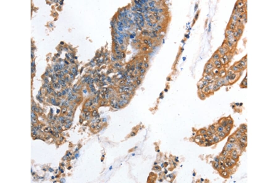 Immunohistochemistry - AKR1D1 Antibody from Signalway Antibody (36072) - Antibodies.com