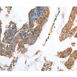 Immunohistochemistry - AKR1D1 Antibody from Signalway Antibody (36072) - Antibodies.com
