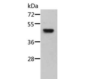 STRADB Antibody from Signalway Antibody (36089) - Antibodies.com
