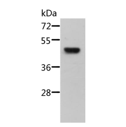STRADB Antibody from Signalway Antibody (36089) - Antibodies.com