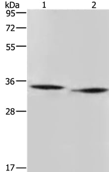 Gel: 10% SDS-PAGE Lysates (from left to right): Mouse heart and liver tissue Amount of lysate: 40ug per lane Primary antibody: 1/500 dilution Secondary antibody dilution: 1/8000 Exposure time: 3 minutes