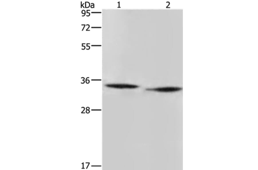 AMDHD2 Antibody from Signalway Antibody (36092) - Antibodies.com