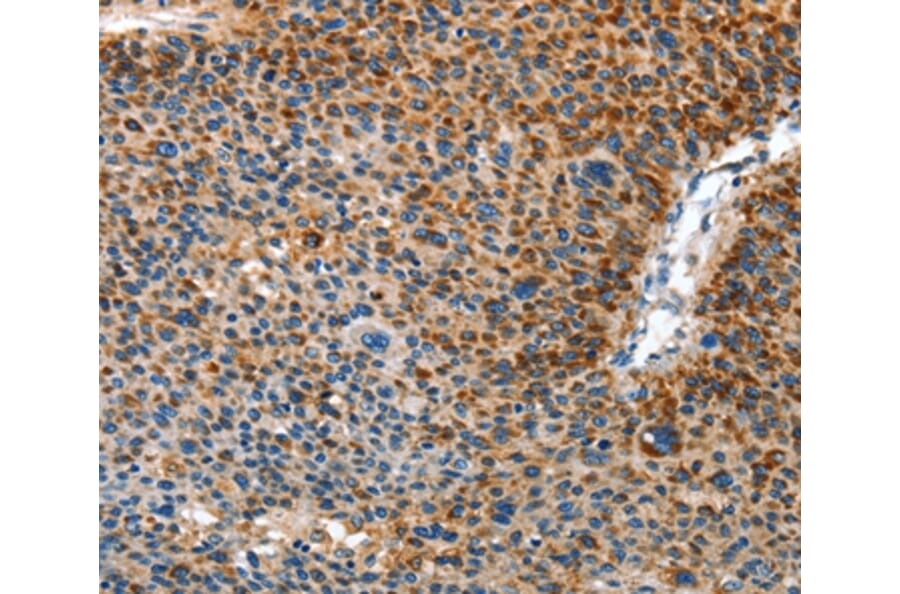 Immunohistochemistry - AMDHD2 Antibody from Signalway Antibody (36092) - Antibodies.com